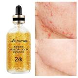 24k Gold Moisturizing Essence---Solve 99% Of Skin Problems