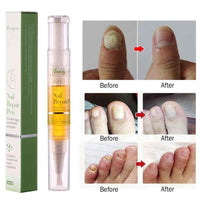 Advanced Fungal Nail Repair Pen